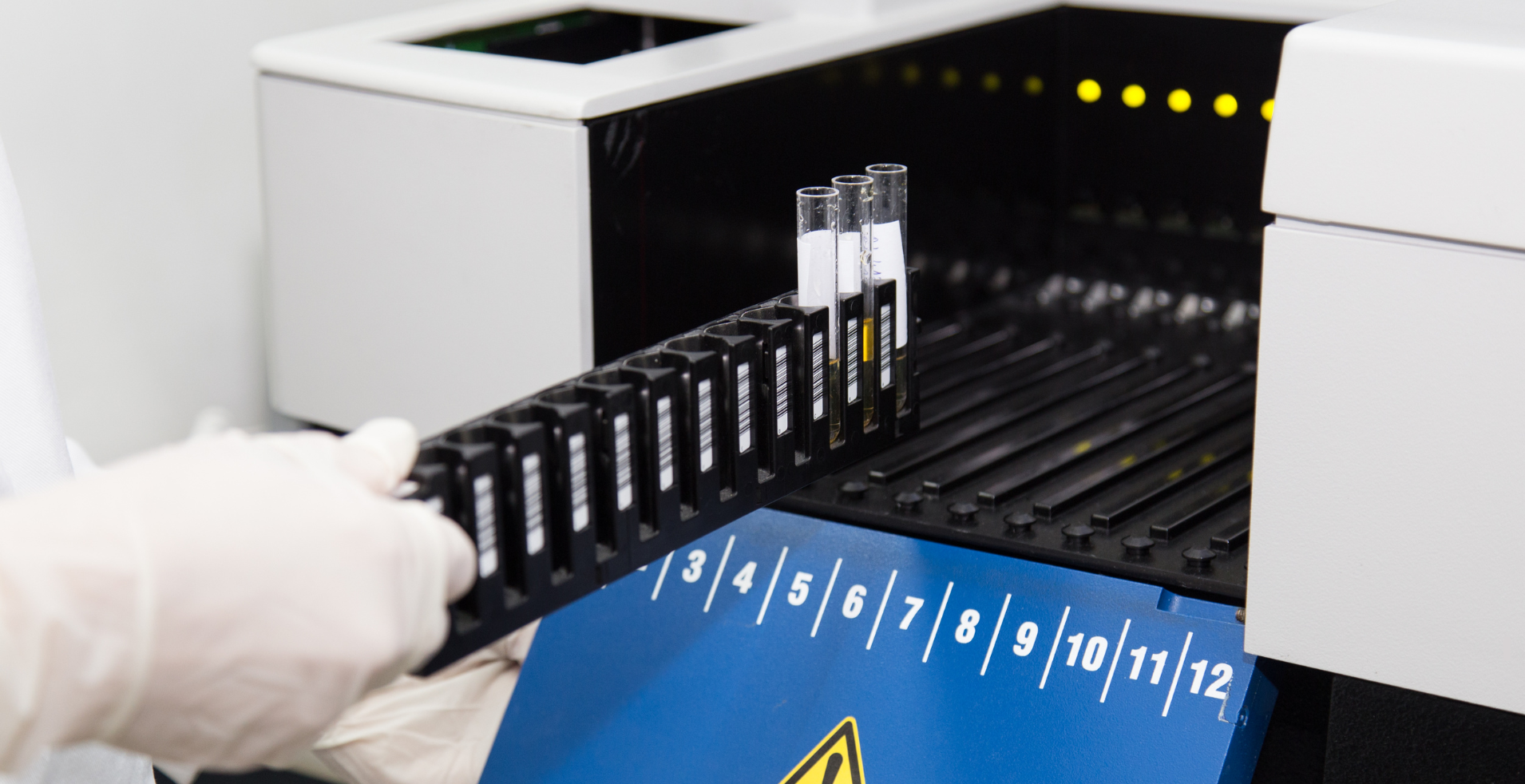 Multiplexed Immunoassays: A Researcher’s Tool for High-Throughput Protein Analysis